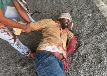 विरुद्ध दिशेने येणाऱ्या बसची दुचाकीला धडक; चालक गंभीर जखमी