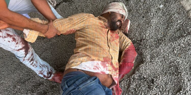 विरुद्ध दिशेने येणाऱ्या बसची दुचाकीला धडक; चालक गंभीर जखमी