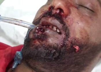 मुंब्रा फायरिंग प्रकरणात एकाचा मृत्यू; आरोपीसह शस्त्र जप्त