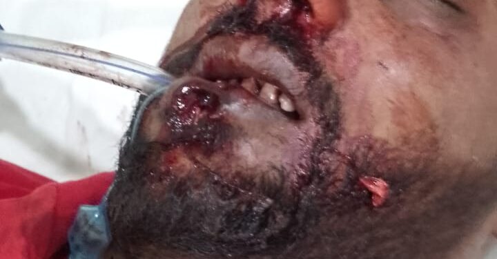 मुंब्रा फायरिंग प्रकरणात एकाचा मृत्यू; आरोपीसह शस्त्र जप्त