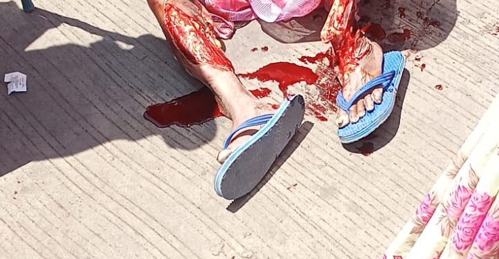 देवळी बसस्थानकात भीषण अपघात; वृद्ध महिलेचे दोन्ही पाय गंभीर जखमी