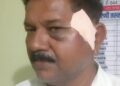 वेगाव, येथील बौद्धिक ट्रस्ट सचिवावर प्राणघातक हल्ला.