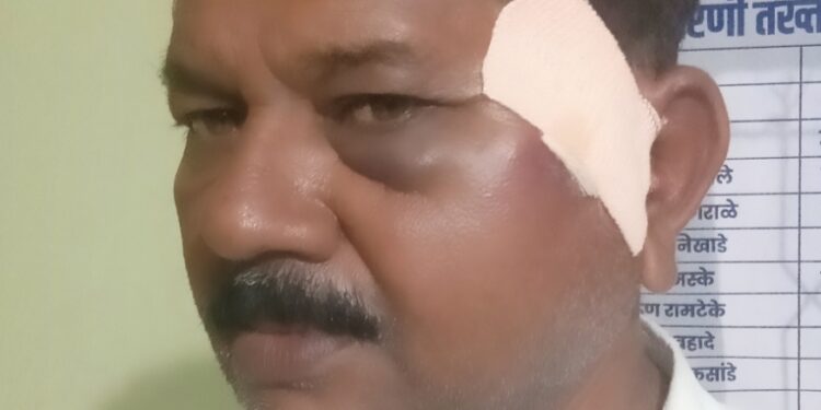 वेगाव, येथील बौद्धिक ट्रस्ट सचिवावर प्राणघातक हल्ला.