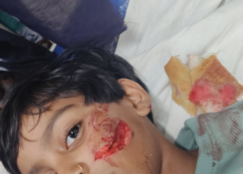 विठ्ठलवाडी प्रभाग क्रमांक १ मध्ये भटक्या कुत्र्यांचा तातडीने बंदोबस्त करण्याची मागणी