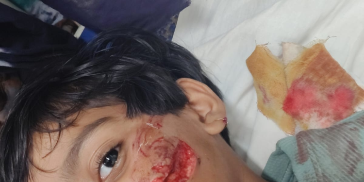 विठ्ठलवाडी प्रभाग क्रमांक १ मध्ये भटक्या कुत्र्यांचा तातडीने बंदोबस्त करण्याची मागणी