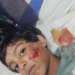 विठ्ठलवाडी प्रभाग क्रमांक १ मध्ये भटक्या कुत्र्यांचा तातडीने बंदोबस्त करण्याची मागणी