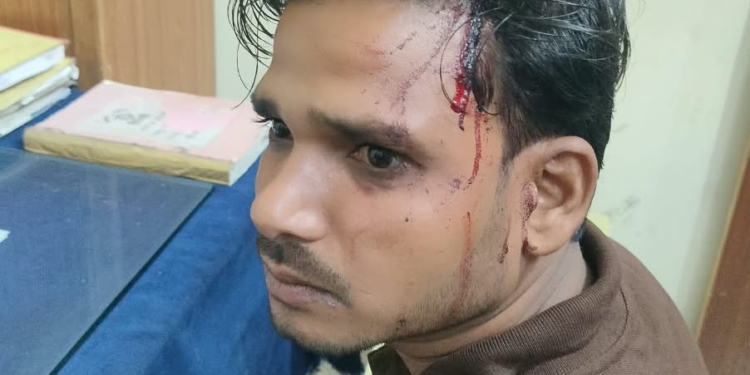 बंदुकीच्या धाकावर अकोल्यातील युवकाला लुटल्याचा आरोप