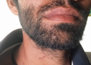 सिसा येथे शेतजमीन नावावर करण्याच्या गैरसमजातून दोघांना मारहाण